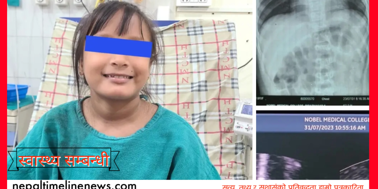  नोवेल अस्पतालमा एक बालिका को मुटुको पवाल (एट्रियल सेप्टल डिफेक्ट) बिना शल्यक्रिया सफलतापुर्वक